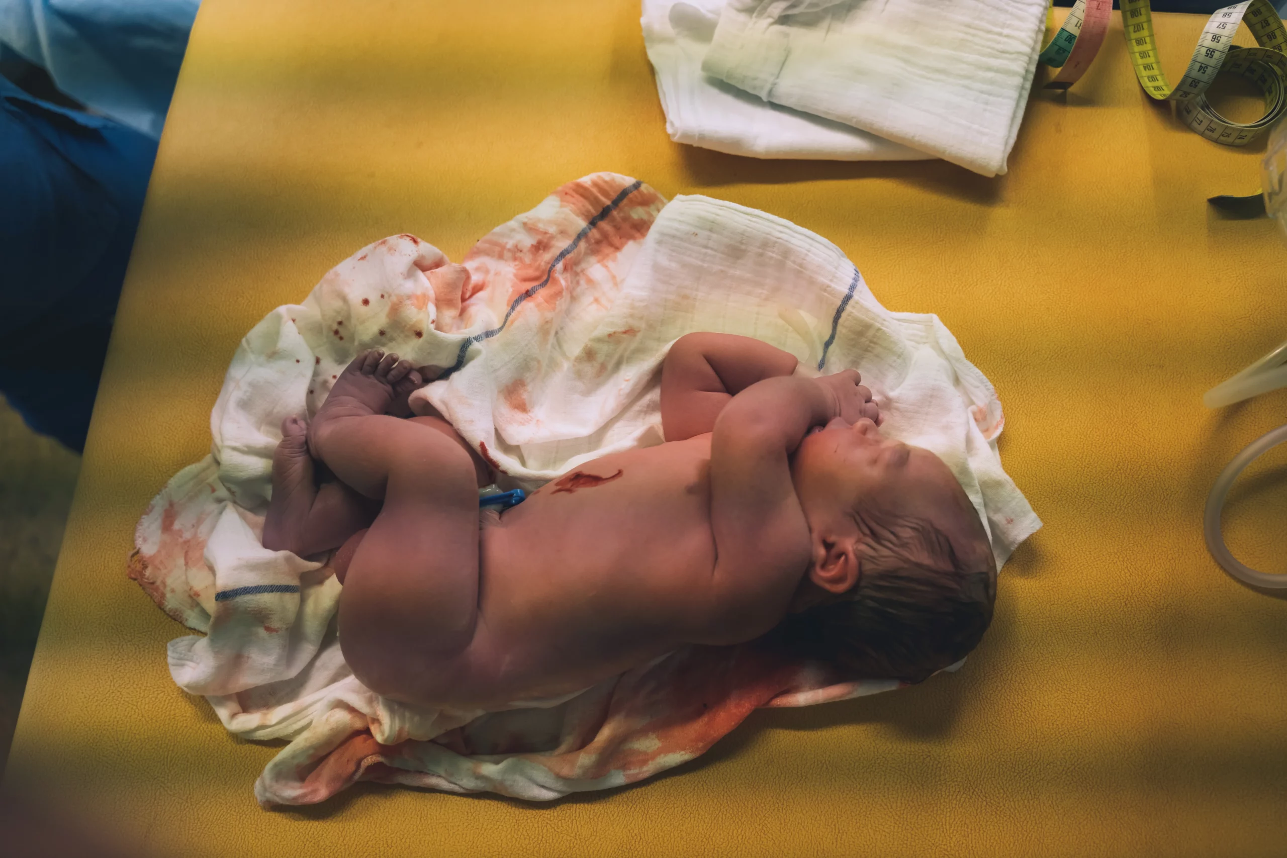 Doctor and midwife examining a newborn after delivery, illustrating medical care and the evidence that may be used to support a Hawaii birth injury claim.